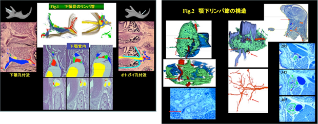 歯科領域におけるリンパ管の利用