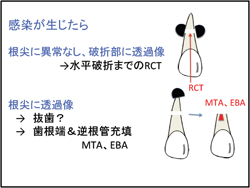 感染が生じたら