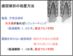 歯冠破折の処置方法