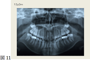 図11