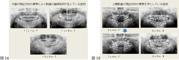 図14，15