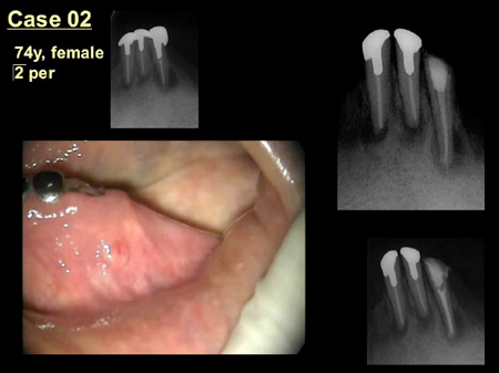 case2