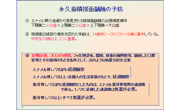 永久歯隣接面齲蝕の予防