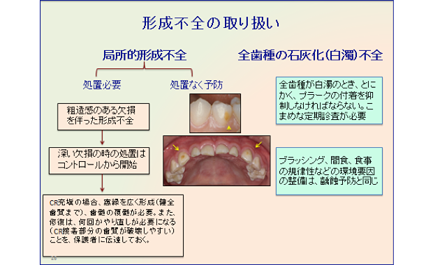 形成不全の取り扱い