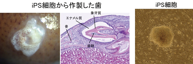 iPS細胞から作製した歯