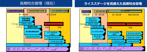 矯正治療における長期咬合管理のコンセプト