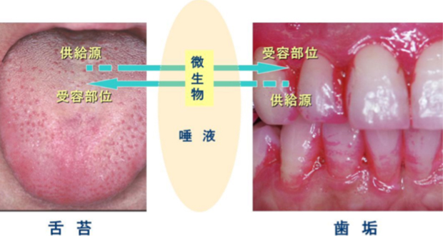 舌苔と歯垢の間に想定される唾液を介しての微生物の供受関係