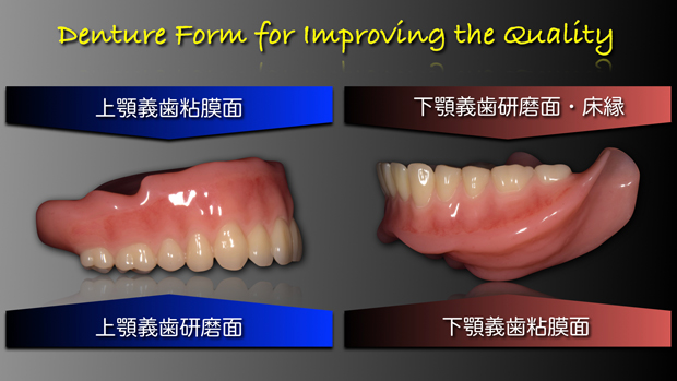 Denture Form for Improving the Quality