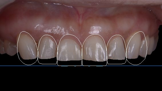 Facially generated treatment planning