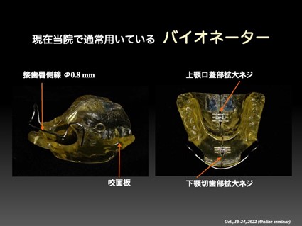 現在当院で通常用いているバイオネーター