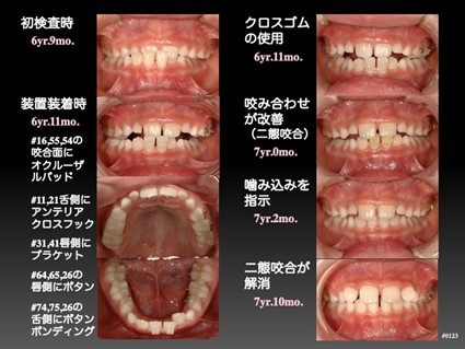 初検査時