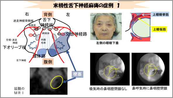 図 7 多彩な症状の出現