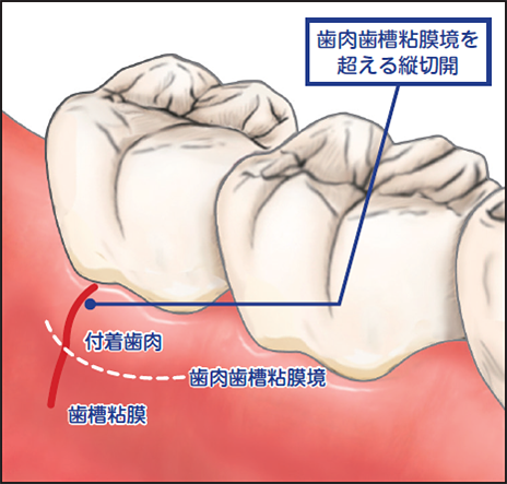 使用上の注意