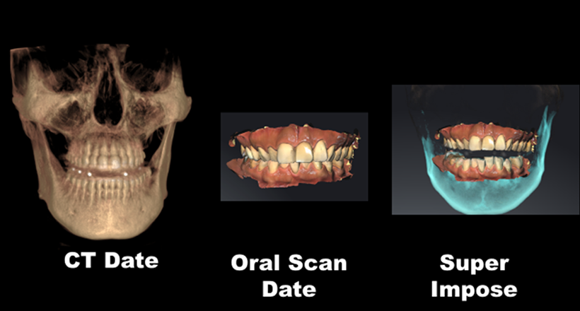 Virtual Articulator