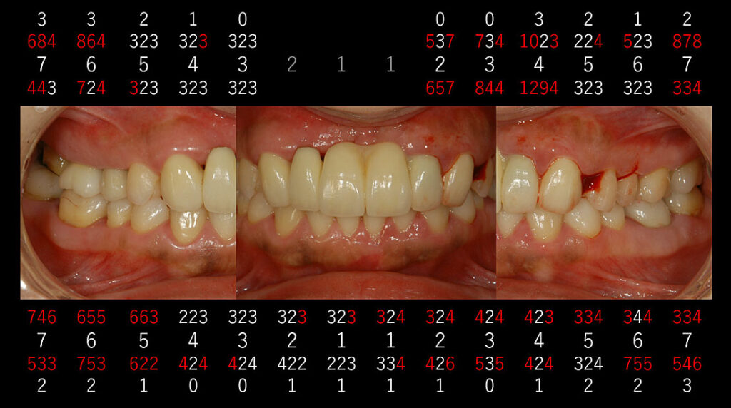 図12